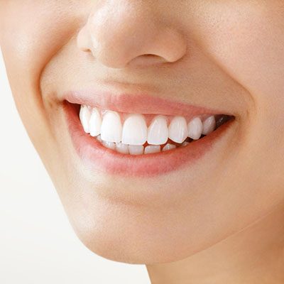 teeth whitening thornton