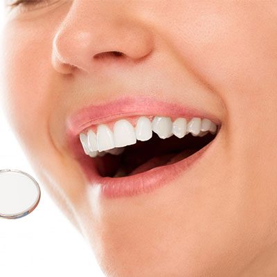 zoom whitening thornton