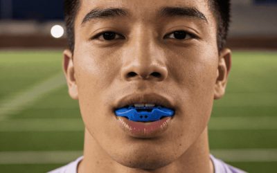 How Do Mouthguards Prevent Dental Injuries on the Footy Field?