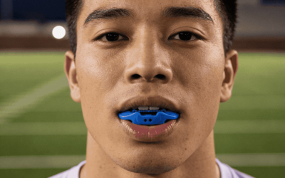 How Do Mouthguards Prevent Dental Injuries on the Footy Field?