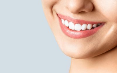 What is a Smile Makeover?