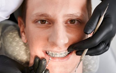 Orthodontic Treatment Options for Crooked Teeth and Jaw Alignment