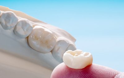 Dental Crowns for Damaged Teeth – Restoring Strength and Function