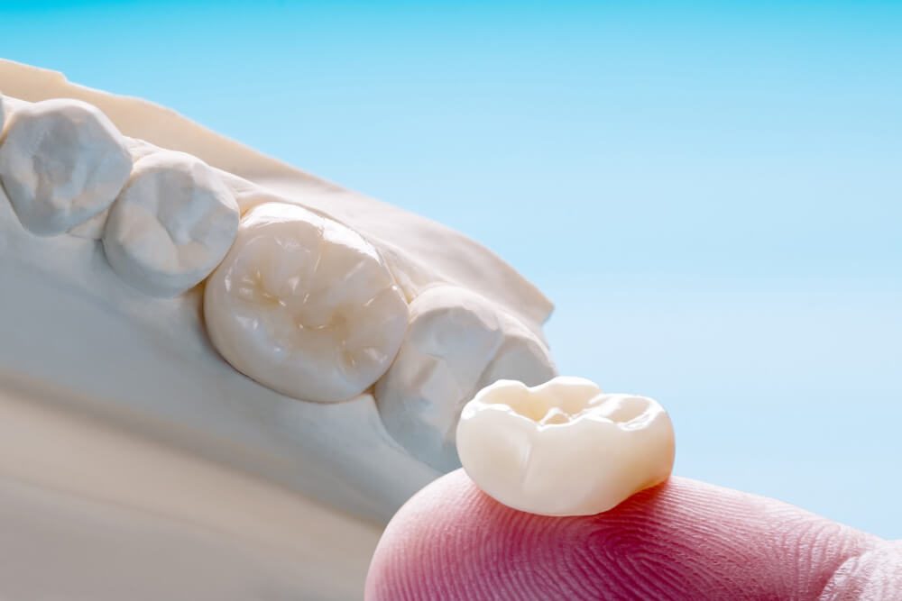 Dental Crowns for Damaged Teeth – Restoring Strength and Function