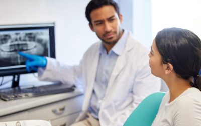 Tooth Extraction: What to Expect Before, During and After