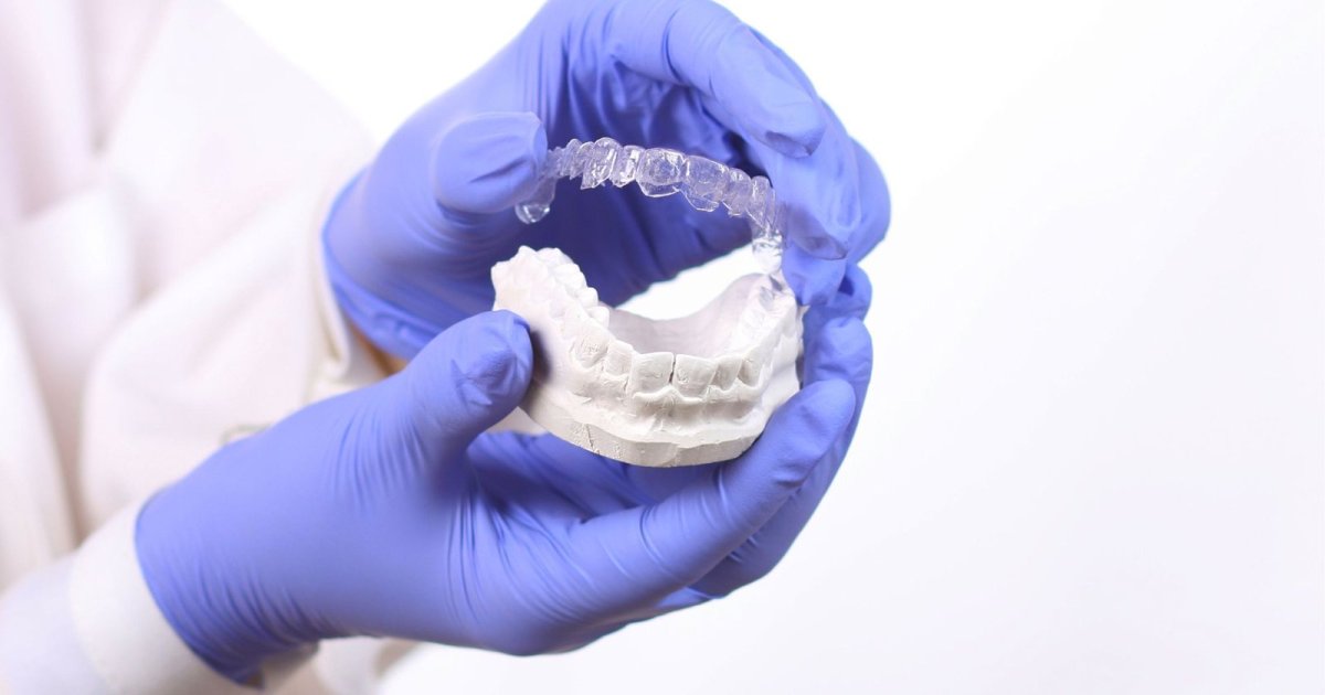 Gloved hands holding a clear dental splint above a plaster model of teeth in Thornton