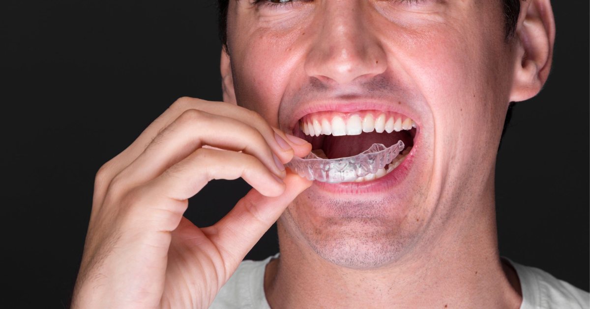 Man placing a clear night guard into his mouth in Thornton